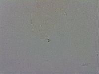 Mesobiotus coronatus image