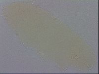 Mesobiotus coronatus image