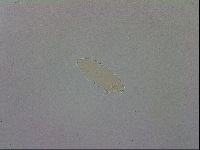 Mesobiotus coronatus image