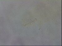 Mesobiotus coronatus image