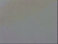 Mesobiotus coronatus image