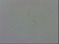 Mesobiotus coronatus image
