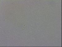Mesobiotus coronatus image