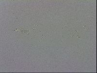 Mesobiotus coronatus image