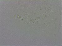 Mesobiotus coronatus image