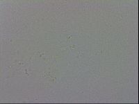 Mesobiotus coronatus image
