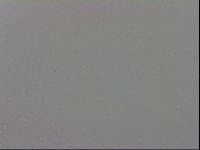 Mesobiotus coronatus image