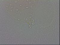 Mesobiotus coronatus image