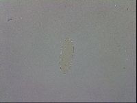 Mesobiotus coronatus image