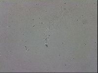 Mesobiotus coronatus image