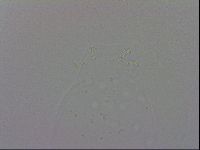 Mesobiotus coronatus image