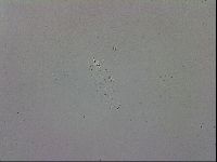 Mesobiotus coronatus image