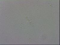 Mesobiotus coronatus image
