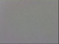 Mesobiotus coronatus image