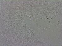 Mesobiotus coronatus image