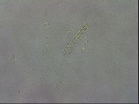 Mesobiotus coronatus image
