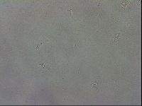 Mesobiotus coronatus image