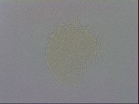 Mesobiotus coronatus image
