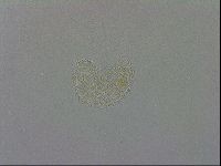 Mesobiotus coronatus image