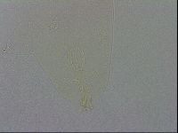 Mesobiotus coronatus image