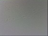 Mesobiotus coronatus image