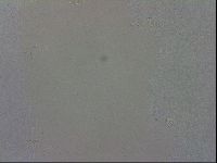 Mesobiotus coronatus image