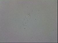 Mesobiotus coronatus image