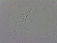 Mesobiotus coronatus image