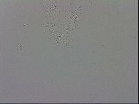 Mesobiotus coronatus image