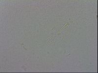 Mesobiotus coronatus image