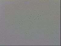 Mesobiotus coronatus image