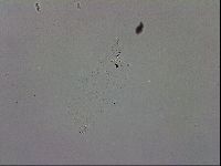Mesobiotus coronatus image