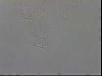 Mesobiotus coronatus image