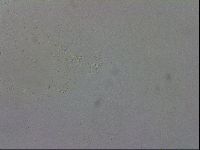 Mesobiotus coronatus image