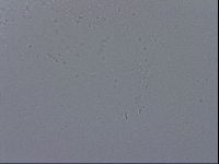 Mesobiotus coronatus image