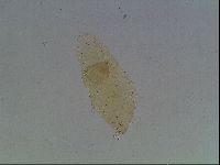 Macrobiotus hibiscus image