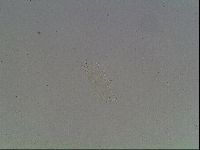 Mesobiotus coronatus image