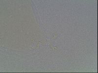 Mesobiotus coronatus image