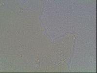 Mesobiotus coronatus image