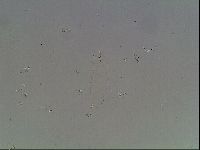Mesobiotus coronatus image