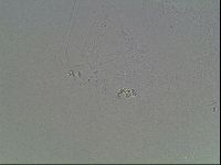 Mesobiotus coronatus image