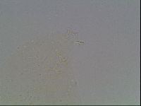 Mesobiotus coronatus image