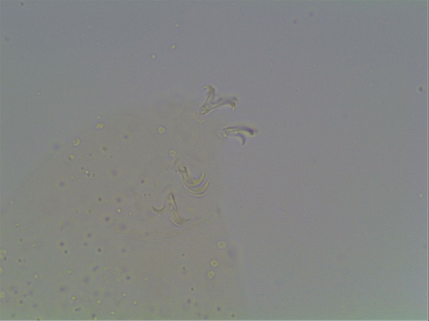 Mesobiotus coronatus image