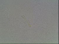 Mesobiotus coronatus image