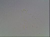 Mesobiotus coronatus image