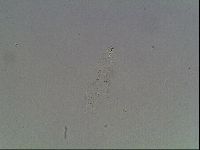 Mesobiotus coronatus image