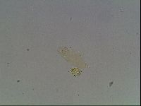 Mesobiotus coronatus image