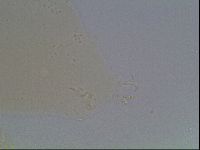 Mesobiotus coronatus image