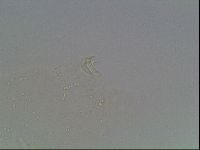Mesobiotus coronatus image