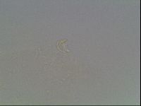 Mesobiotus coronatus image